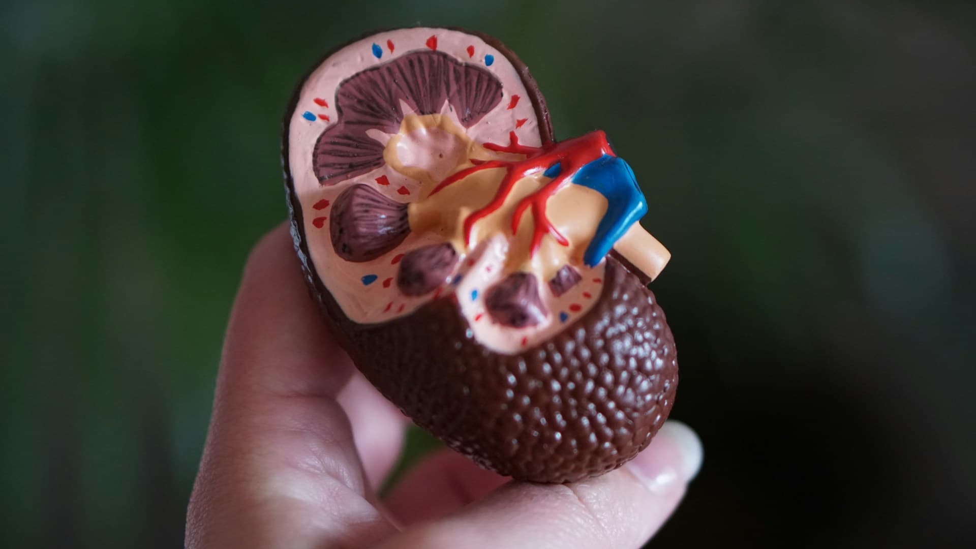Kenali Penyebab Gagal Ginjal Demi Jaga Fungsi Organ Tetap Optimal