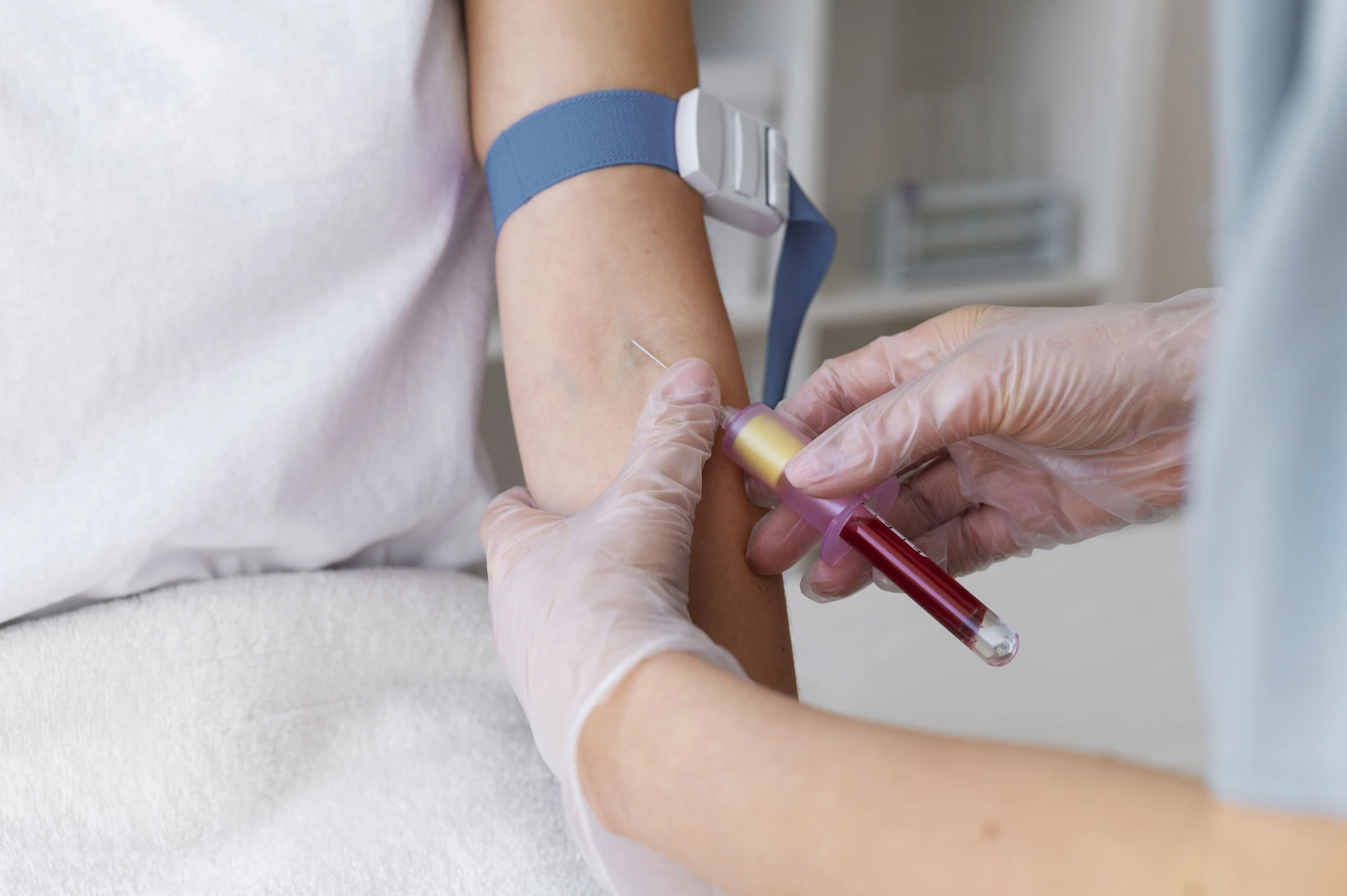 pemeriksaan-hba2-deteksi-thalassemia-dewasa