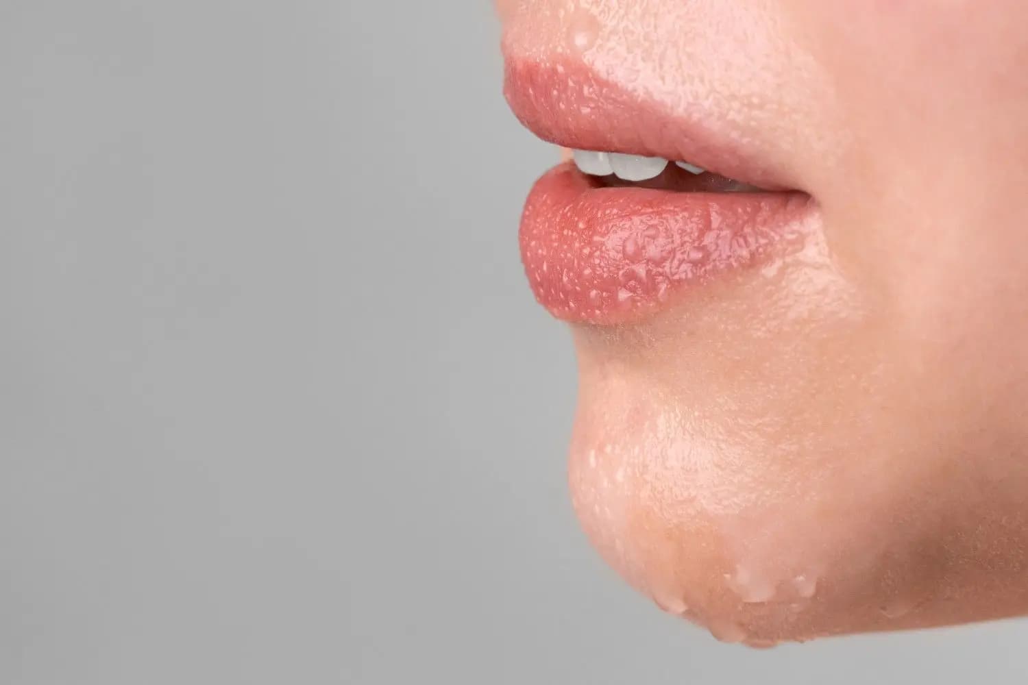tes-ims-infeksi-menular-seksual